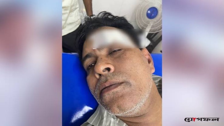 চকরিয়ায় সংঘর্ষ থামাতে গিয়ে বিএনপি নেতা হামলার শিকার